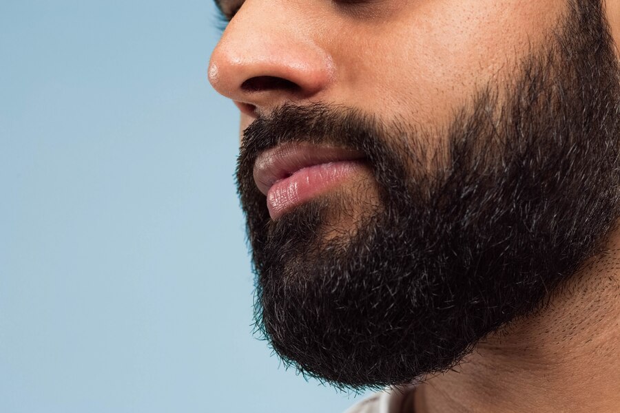 Transplante de Barba