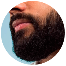 Transplante de Barba