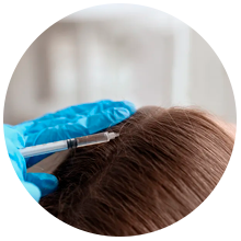 Mesoterapia Capilar